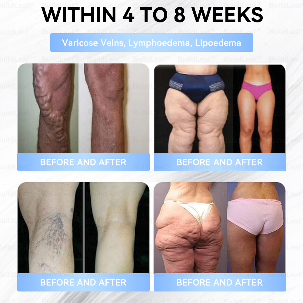 👨⚕️🏥FDA Store |𝐵uil𝗱𝐿ea𝐟® 𝑮𝐋𝑃-1 Slim & Firm 𝑁ano 𝑀icroneedle 𝑃atch with Collagen,Turmeric&Matrixyl 3000 丨Obesity,Cardiovascular Diseas, Diabetes, Sleep Apnea, Joint Problems and More