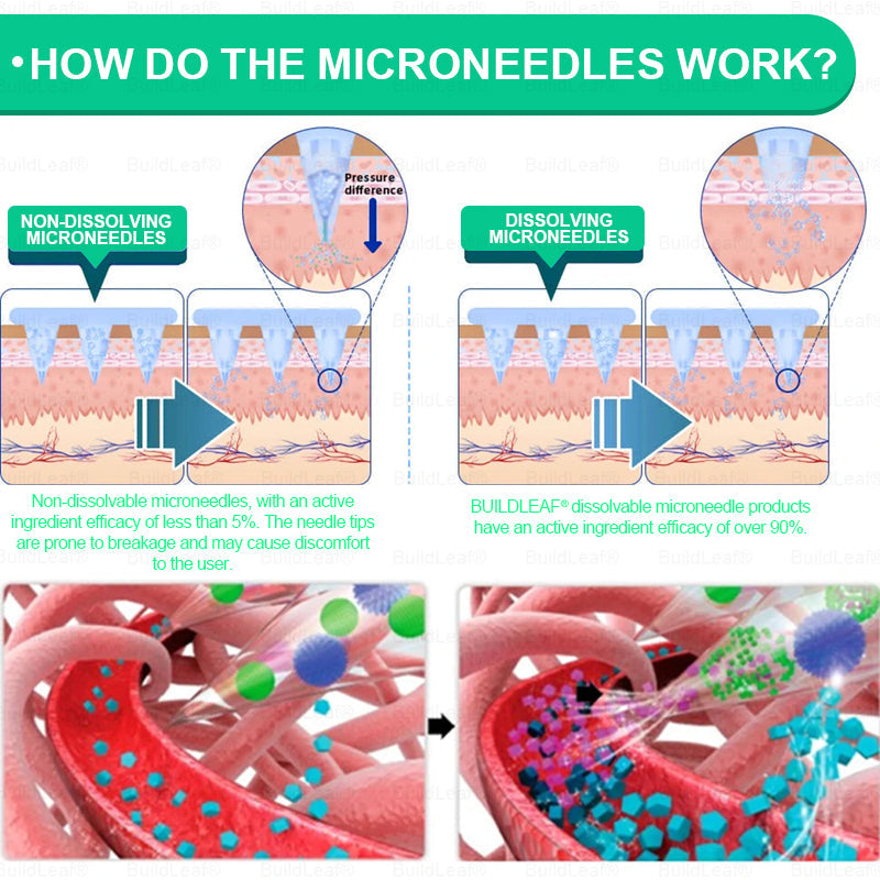 🔥🏥Official Store | BuildLeaf® GLP-1 Nano-Microneedle Patch with Collagen & Matrixyl 3000 丨Obesity,Cardiovascular Diseas, Diabetes, Sleep Apnea, Joint Problems and More