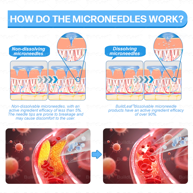 👨⚕️🏥FDA Store |𝐵uil𝗱𝐿ea𝐟® 𝑮𝐋𝑃-1 Slim & Firm 𝑁ano 𝑀icroneedle 𝑃atch with Collagen,Turmeric&Matrixyl 3000 丨Obesity,Cardiovascular Diseas, Diabetes, Sleep Apnea, Joint Problems and More