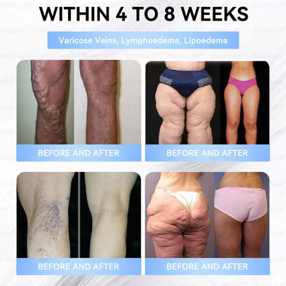 👨‍⚕️🏥FDA Store |𝐵uil𝗱𝐿ea𝐟® 𝑮𝐋𝑃-1 Slim & Firm 𝑁ano 𝑀icroneedle 𝑃atch with Collagen,Turmeric&Matrixyl 3000 丨Obesity,Cardiovascular Diseas, Diabetes, Sleep Apnea, Joint Problems and More