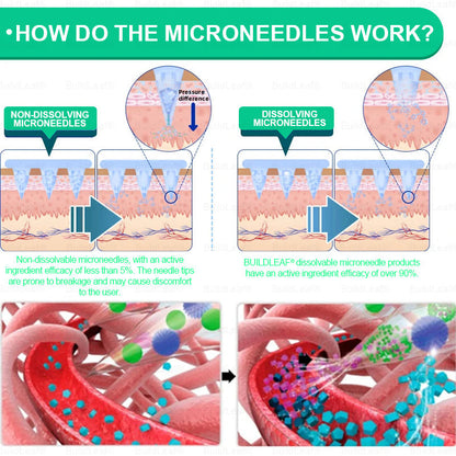 🔥🏥Official Store | BuildLeaf® GLP-1 Nano-Microneedle Patch with Collagen & Matrixyl 3000 丨Obesity,Cardiovascular Diseas, Diabetes, Sleep Apnea, Joint Problems and More