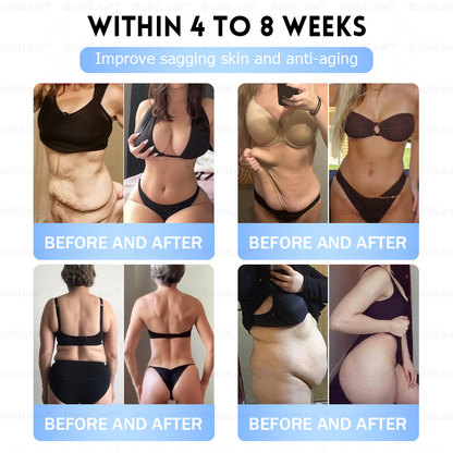 👨‍⚕️🏥FDA Store |𝐵uil𝗱𝐿ea𝐟® 𝑮𝐋𝑃-1 Slim & Firm 𝑁ano 𝑀icroneedle 𝑃atch with Collagen,Turmeric&Matrixyl 3000 丨Obesity,Cardiovascular Diseas, Diabetes, Sleep Apnea, Joint Problems and More